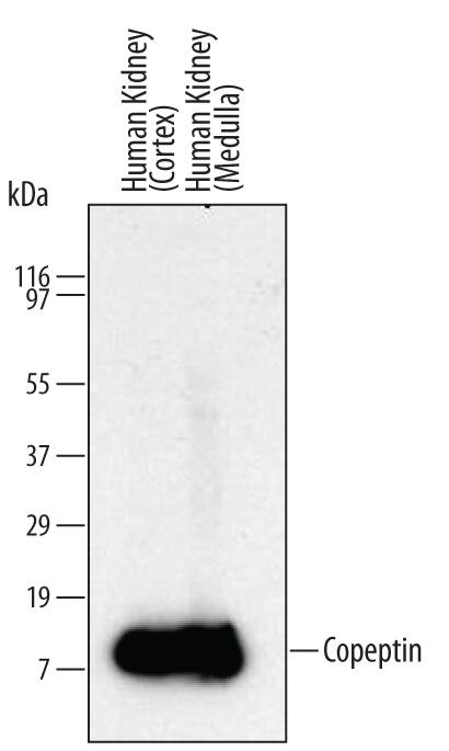 Western Blot Copeptin Antibody (579021)