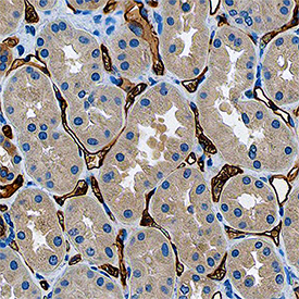 Corin was detected in immersion fixed paraffin-embedded sections of human liver using Goat Anti-Human Corin Antigen Affinity-purified Polyclonal Antibody (Catalog # AF2209) at 3 µg/mL for 1 hour at room temperature followed by incubation with the Anti-Goat IgG VisUCyte™ HRP Polymer Antibody (Catalog # VC004). Before incubation with the primary antibody, tissue was subjected to heat-induced epitope retrieval using Antigen Retrieval Reagent-Basic (Catalog # CTS013). Tissue was stained using DAB (brown) and counterstained with hematoxylin (blue). Specific staining was localized to endothelial cells in canaliculi. View our protocol for IHC Staining with VisUCyte HRP Polymer Detection Reagents.