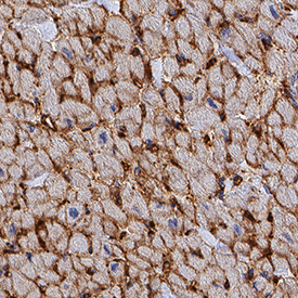 Corin was detected in immersion fixed paraffin-embedded sections of human heart using Goat Anti-Human Corin Antigen Affinity-purified Polyclonal Antibody (Catalog # AF2209) at 0.3 µg/mL for 1 hour at room temperature followed by incubation with the Anti-Goat IgG VisUCyte™ HRP Polymer Antibody (Catalog # VC004). Before incubation with the primary antibody, tissue was subjected to heat-induced epitope retrieval using Antigen Retrieval Reagent-Basic (Catalog # CTS013). Tissue was stained using DAB (brown) and counterstained with hematoxylin (blue). Specific staining was localized to cytoplasm in cardiomyocytes. View our protocol for IHC Staining with VisUCyte HRP Polymer Detection Reagents.