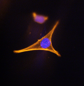 Corin was detected in immersion fixed HK2 human kidney proximal tubule cell line using Rat Anti-Human Corin Monoclonal Antibody (Catalog # MAB2209) at 25 µg/mL for 3 hours at room temperature. Cells were stained using the NorthernLights™ 557-conjugated Anti-Rat IgG Secondary Antibody (red; Catalog # NL013) and counterstained with DAPI (blue). Specific staining was localized to plasma membranes. View our protocol for Fluorescent ICC Staining of Cells on Coverslips.