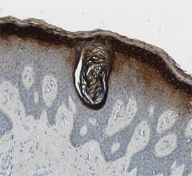 Immunohistochemistry Corneodesmosin Antibody [Unconjugated]