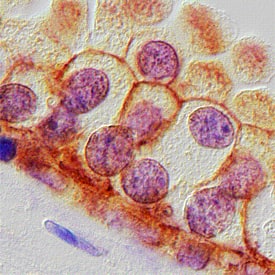 Cortactin was detected in immersion fixed paraffin-embedded sections of human prostate using Mouse Anti-Human Cortactin Monoclonal Antibody (Catalog # MAB6096) at 15 µg/mL overnight at 4 °C. Before incubation with the primary antibody, tissue was subjected to heat-induced epitope retrieval using Antigen Retrieval Reagent-Basic (Catalog # CTS013). Tissue was stained using the Anti-Mouse HRP-DAB Cell & Tissue Staining Kit (brown; Catalog # CTS002) and counterstained with hematoxylin (blue). Specific staining was localized to the plasma membranes of glandular epithelial cells. View our protocol for Chromogenic IHC Staining of Paraffin-embedded Tissue Sections.