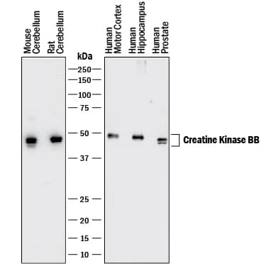 Western blot shows lysates of mouse and rat brain (cerebellum) tissue, human brain (motor cortex and hippocampus) tissue, and human prostate tissue. PVDF membrane was probed with 0.1 µg/mL of Mouse Anti-Human/ Mouse/Rat Creatine Kinase BB Monoclonal Antibody (Catalog # MAB9076) followed by HRP-conjugated Anti-Mouse IgG Secondary Antibody (Catalog # HAF018). A specific band was detected for Creatine Kinase BB at approximately 45 kDa (as indicated). This experiment was conducted under reducing conditions and using Immunoblot Buffer Group 1.