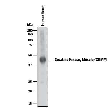 Western Blot Creatine Kinase, Muscle/CKMM Antibody (492731) [Unconjugated]