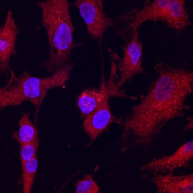 Crossveinless-2/CV-2 was detected in immersion fixed HUVEC human umbilical vein endothelial cells using Human Crossveinless-2/CV-2 Antigen Affinity-purified Polyclonal Antibody (Catalog # AF1956) at 10 µg/mL for 3 hours at room temperature. Cells were stained using the NorthernLights™ 557-conjugated Anti-Sheep IgG Secondary Antibody (red; Catalog # NL010) and counterstained with DAPI (blue). Specific staining was localized to cytoplasm. View our protocol for Fluorescent ICC Staining of Cells on Coverslips.