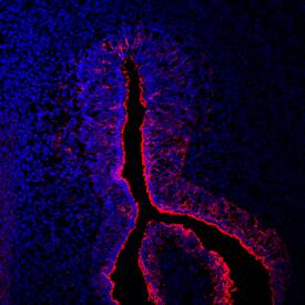 Crossveinless-2/CV-2 was detected in immersion fixed frozen sections of mouse embryo (E13.5) using Mouse Crossveinless-2/CV-2 Antigen Affinity-purified Polyclonal Antibody (Catalog # AF2299) at 10 µg/mL overnight at 4 °C. Tissue was stained using the NorthernLights™ 557-conjugated Anti-Goat IgG Secondary Antibody (red; Catalog # NL001) and counterstained with DAPI (blue). Specific staining was localized to the epithelium surrounding the nasal cavity. View our protocol for Fluorescent IHC Staining of Frozen Tissue Sections.