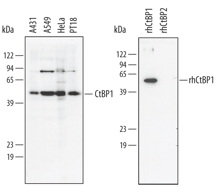 Western blot shows lysates of A431 human epithelial carcinoma cell line, A549 human lung carcinoma cell line, HeLa human cervical epithelial carcinoma cell line, and PT18 mouse mast/basophil cell line. PVDF membrane was probed with 1 µg/mL Goat Anti-Human CtBP1 Antigen Affinity-purified Polyclonal Antibody (Catalog # AF4639) followed by HRP-conjugated Anti-Goat IgG Secondary Antibody (Catalog # HAF109). For additional reference, recombinant human CtBP1 and CtBP2 (5 ng/lane) were included. A specific band for CtBP1 was detected at approximately 48 kDa (as indicated). This experiment was conducted under reducing conditions and using Immunoblot Buffer Group 1.