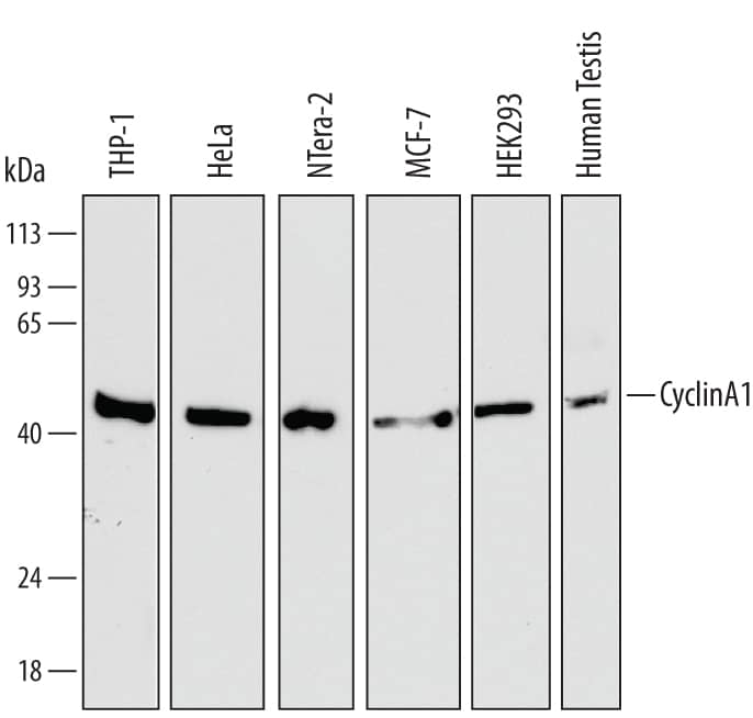 Western Blot Cyclin A1 Antibody (722407) [Unconjugated]