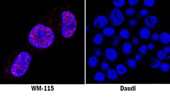 Cyclin D1 was detected in immersion fixed WM-115 human malignant melanoma cell line (positive stain) and Daudi human Burkitt's lymphoma cell line (negative stain) using Mouse Anti-Human Cyclin D1 Monoclonal Antibody (Catalog # MAB43142) at 8 µg/mL for 3 hours at room temperature. Cells were stained using the NorthernLights™ 557-conjugated Anti-Mouse IgG Secondary Antibody (red; Catalog # NL007) and counterstained with DAPI (blue). Specific staining was localized to nuclei. View our protocol for Fluorescent ICC Staining of Cells on Coverslips.