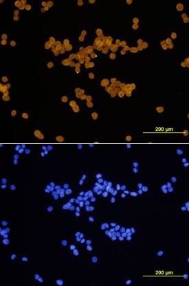 Cyclin D1 was detected in immersion fixed COLO 205 human colorectal adenocarcinoma cell line using Mouse Anti-Human Cyclin D1 Monoclonal Antibody (Catalog # MAB4314) at 10 µg/mL for 3 hours at room temperature. Cells were stained using the NorthernLights™ 557-conjugated Anti-Mouse IgG Secondary Antibody (yellow, upper panel; Catalog # NL007) and counterstained with DAPI (blue, lower panel). View our protocol for Fluorescent ICC Staining of Cells on Coverslips.