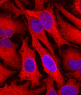 Cyclophilin B was detected in immersion fixed HeLa human cervical epithelial carcinoma cell line using Goat Anti-Human/Mouse/Rat Cyclophilin B Antigen Affinity-purified Polyclonal Antibody (Catalog # AF5410) at 10 µg/mL for 3 hours at room temperature. Cells were stained using the Northern-Lights™ 557-conjugated Anti-Goat IgG Secondary Antibody (red; Catalog # NL001) and counterstained with DAPI (blue). Specific staining was localized to cytoplasm. View our protocol for Fluorescent ICC Staining of Cells on Coverslips.