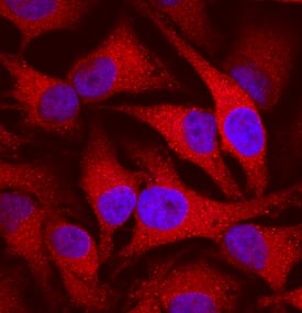 Cyclophilin B was detected in immersion fixed HeLa human cervical epithelial carcinoma cell line using Mouse Anti-Human/Mouse/Rat Cyclophilin B Monoclonal Antibody (Catalog # MAB5410) at 10 µg/mL for 3 hours at room temperature. Cells were stained using the NorthernLights™ 557-conjugated Anti-Mouse IgG Secondary Antibody (red; Catalog # NL007) and counterstained with DAPI (blue). Specific staining was localized to cytoplasm. View our protocol for Fluorescent ICC Staining of Cells on Coverslips.