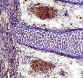 Cyr61/CCN1 was detected in immersion fixed frozen sections of mouse embryo (13 d.p.c.) using 15 &micro;g/mL Mouse Cyr61/CCN1 Antigen Affinity-purified Polyclonal Antibody (Catalog # AF4055) overnight at 4 &deg;C. Tissue was stained with the Anti-Sheep HRP-DAB Cell & Tissue Staining Kit (brown; Catalog # CTS019) and counterstained with hematoxylin (blue). Specific labeling was localized to the cytoplasm of muscle cells. View our protocol for Chromogenic IHC Staining of Frozen Tissue Sections.
