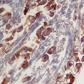 Cyr61/CCN1 was detected in perfusion fixed frozen sections of mouse trigeminal ganglia using 25 &micro;g/mL Rat Anti-Mouse Cyr61/CCN1 Monoclonal Antibody (Catalog # MAB4864) overnight at 4 &deg;C. Tissue was stained with the Anti-Rat HRP-DAB Cell & Tissue Staining Kit (brown; Catalog # CTS017) and counterstained with hematoxylin (blue). View our protocol for Chromogenic IHC Staining of Frozen Tissue Sections.