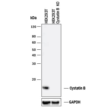 Knockout Validated Cystatin B/Stefin B Antibody [Unconjugated]