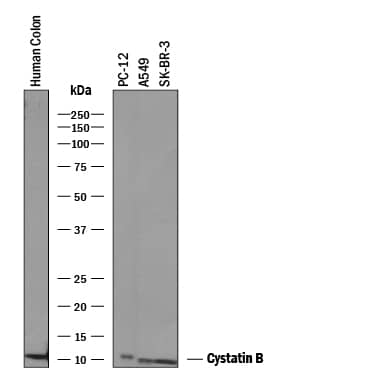 Western Blot Cystatin B/Stefin B Antibody [Unconjugated]