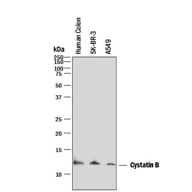 Western blot shows lysates of human colon tissue, SK-BR-3 human breast cancer cell line, and A549 human lung carcinoma cell line. PVDF membrane was probed with 2 µg/mL of Mouse Anti-Human Cystatin B Monoclonal Antibody (Catalog # MAB1408) followed by HRP-conjugated Anti-Mouse IgG Secondary Antibody (Catalog # HAF018). A specific band was detected for Cystatin B at approximately 12 kDa (as indicated). This experiment was conducted under reducing conditions and using Immunoblot Buffer Group 1.