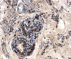 Cystatin C was detected in immersion fixed paraffin-embedded sections of human breast using 5 µg/mL Goat Anti-Human Cystatin C Antigen Affinity-purified Polyclonal Antibody (Catalog # AF1196) overnight at 4 °C. Tissue was stained with the Anti-Goat HRP-DAB Cell & Tissue Staining Kit (brown; Catalog # CTS008) and counterstained with hematoxylin (blue). Specific labeling was localized to the cytoplasm in cells of terminal ductules. View our protocol for Chromogenic IHC Staining of Paraffin-embedded Tissue Sections.