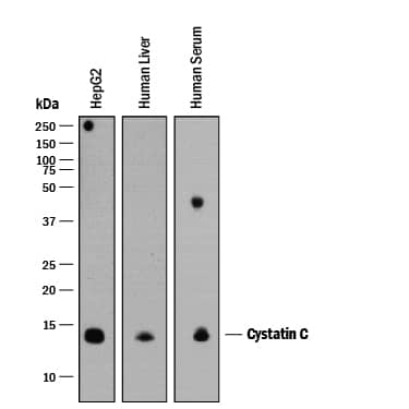 Western blot shows lysates of HepG2 human hepatocellular carcinoma cell line, human liver tissue, and human serum. PVDF membrane was probed with 0.25 µg/mL of Goat Anti-Human Cystatin C Antigen Affinity-purified Polyclonal Antibody (Catalog # AF1196) followed by HRP-conjugated Anti-Goat IgG Secondary Antibody (Catalog # HAF109). A specific band was detected for Cystatin C at approximately 14 kDa (as indicated). This experiment was conducted under reducing conditions and using Immunoblot Buffer Group 1.