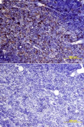 Cystatin C was detected in immersion fixed frozen sections of mouse spleen using Mouse Cystatin C Antigen Affinity-purified Polyclonal Antibody (Catalog # AF1238) at 15 µg/mL overnight at 4 °C. Tissue was stained using the Anti-Goat HRP-DAB Cell & Tissue Staining Kit (brown; Catalog # CTS008) and counterstained with hematoxylin (blue). Lower panel shows a lack of labeling if primary antibodies are omitted and tissue is stained only with secondary antibody followed by incubation with detection reagents. View our protocol for Chromogenic IHC Staining of Frozen Tissue Sections.