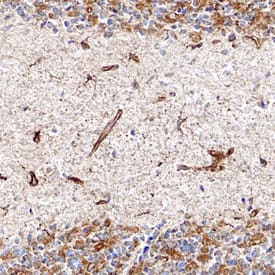 Cystatin C was detected in perfusion fixed frozen sections of rat brain (cerebellum) using Sheep Anti-Rat Cystatin C Antigen Affinity-purified Polyclonal Antibody (Catalog # AF6154) at 1.7 µg/mL overnight at 4 °C. Tissue was stained using the Anti-Sheep HRP-DAB Cell & Tissue Staining Kit (brown; CTS019) and counterstained with hematoxylin (blue). Specific staining was localized to neurons in the molecular layer of the cerebellum. View our protocol for Chromogenic IHC Staining of Frozen Tissue Sections.