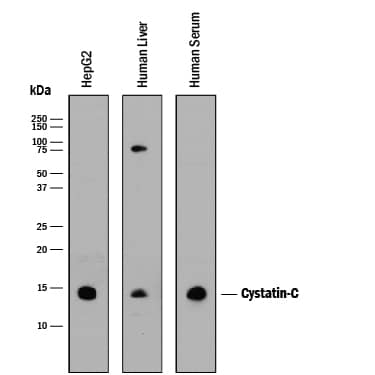 Western blot shows lysates of HepG2 human hepatocellular carcinoma cell line, human liver tissue, and human serum. PVDF membrane was probed with 1 µg/mL of Mouse Anti-Human Cystatin C Monoclonal Antibody (Catalog # MAB1196) followed by HRP-conjugated Anti-Mouse IgG Secondary Antibody (Catalog # HAF018). A specific band was detected for Cystatin C at approximately 14 kDa (as indicated). This experiment was conducted under reducing conditions and using Immunoblot Buffer Group 1.