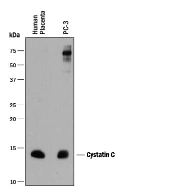 Western blot shows lysates of human placenta tissue and PC-3 human prostate cancer cell line. PVDF membrane was probed with 2 µg/mL of Mouse Anti-Human Cystatin C Monoclonal Antibody (Catalog # MAB1196) followed by HRP-conjugated Anti-Mouse IgG Secondary Antibody (Catalog # HAF018). A specific band was detected for Cystatin C at approximately 14 kDa (as indicated). This experiment was conducted under reducing conditions and using Immunoblot Buffer Group 1.