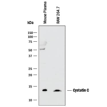 Western blot shows lysates of mouse plasma and RAW 264.7 mouse monocyte/macrophage cell line. PVDF membrane was probed with 2 µg/mL of Rat Anti-Mouse Cystatin C Monoclonal Antibody (Catalog # MAB1238) followed by HRP-conjugated Anti-Rat IgG Secondary Antibody (Catalog # HAF005). A specific band was detected for Cystatin C at approximately 14 kDa (as indicated). This experiment was conducted under reducing conditions and using Immunoblot Buffer Group 1.