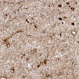 Cystatin C was detected in perfusion fixed frozen sections of rat brain using Mouse Anti-Rat Cystatin C Monoclonal Antibody (Catalog # MAB6154) at 15 µg/mL overnight at 4 °C. Tissue was stained using the Anti-Mouse HRP-DAB Cell & Tissue Staining Kit (brown; Catalog # CTS002) and counter-stained with hematoxylin (blue). Specific staining was localized to endothelial cells in vasculature. View our protocol for Chromogenic IHC Staining of Frozen Tissue Sections.