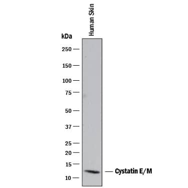 Western Blot Cystatin E/M/CST6 Antibody [Unconjugated]