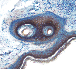 Cystatin E/M was detected in immersion fixed paraffin-embedded sections of human skin using 25 µg/mL Mouse Anti-Human Cystatin E/M Monoclonal Antibody (Catalog # MAB1286) overnight at 4 °C. Tissue was stained with the Anti-Mouse HRP-DAB Cell & Tissue Staining Kit (brown; Catalog # CTS002) and counterstained with hematoxylin (blue). Specific labeling was localized to the cytoplasm of cells in hair follicules. View our protocol for Chromogenic IHC Staining of Paraffin-embedded Tissue Sections.