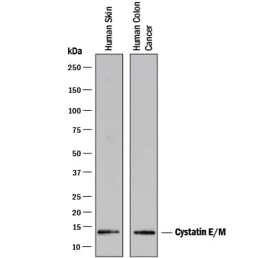 Western blot shows lysates of human skin tissue and human colon cancer tissue. PVDF membrane was probed with 2 µg/mL of Mouse Anti-Human Cystatin E/M Monoclonal Antibody (Catalog # MAB1286) followed by HRP-conjugated Anti-Mouse IgG Secondary Antibody (Catalog # HAF007). A specific band was detected for Cystatin E/M at approximately 13 kDa (as indicated). This experiment was conducted under reducing conditions and using Immunoblot Buffer Group 1.
