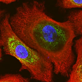 Cytokeratin 14 was detected in immersion fixed NHEK human normal epidermal keratinocytes using Mouse Anti-Human Cytokeratin 14 Monoclonal Antibody (Catalog # MAB3164) at 10 µg/mL for 3 hours at room temperature. Cells were stained using the NorthernLights™ 557-conjugated Anti-Mouse IgG Secondary Antibody (red; Catalog # NL007). CKAP4/p63 was also detected using Sheep Anti-Human CKAP4/p63 Affinity-purified Polyclonal Antibody (Catalog # AF7355) and stained using the NorthernLights™ 493-conjugated Anti-Sheep IgG Secondary Antibody (green; Catalog # NL012). Cells were counterstained with DAPI (blue). Specific staining of Cytokeratin 14 was localized to intermediate filaments. View our protocol for Fluorescent ICC Staining of Cells on Coverslips.