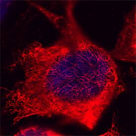 Immunocytochemistry Cytokeratin 18 Antibody [Unconjugated]