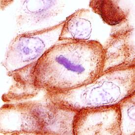 Immunohistochemistry Cytokeratin 18 Antibody [Unconjugated]