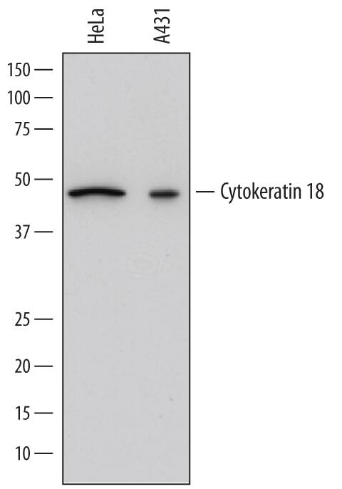 Western Blot Cytokeratin 18 Antibody [Unconjugated]