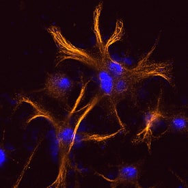 Cytokeratin 18 was detected in formaldehyde fixed HeLa human cervical epithelial carcinoma cell line using Mouse Anti-Human Cytokeratin 18 Biotinylated Monoclonal Antibody (Catalog # BAM7619) at 25 µg/mL overnight at 4 °C. Cells were stained using the NorthernLights™ 557-conjugated Streptavidin (orange; Catalog # NL999) and counterstained with DAPI (blue). Specific staining was localized to intermediate filaments. View our protocol for Fluorescent ICC Staining of Cells on Coverslips.