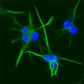 Cytokeratin 18 was detected in formaldehyde fixed HeLa human cervical epithelial carcinoma cell line using Mouse Anti-Human Cytokeratin 18 Alexa Fluor® 488‑conjugated Monoclonal Antibody (Catalog # IC7619G) at 1:10 dilution overnight at 4 °C and counterstained with DAPI (blue). Specific staining was localized to intermediate filaments. View our protocol for Fluorescent ICC Staining of Cells on Coverslips.
