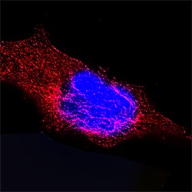Immunocytochemistry Cytokeratin 18 Antibody (810811) [Unconjugated]