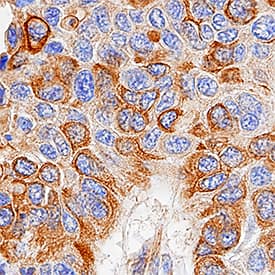 Immunohistochemistry Cytokeratin 18 Antibody (810811) [Unconjugated]