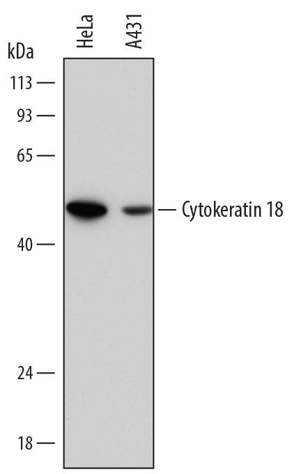 Western Blot Cytokeratin 18 Antibody (810811) [Unconjugated]