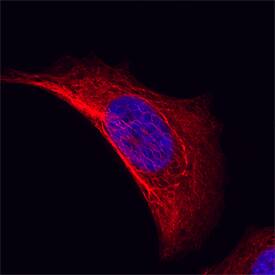 Cytokeratin 19 was detected in immersion fixed MCF-7 human breast cancer cell line using Sheep Anti-Human Cytokeratin 19 Antigen Affinity-purified Polyclonal Antibody (Catalog # AF3506) at 10 µg/mL for 3 hours at room temperature. Cells were stained using the NorthernLights™ 557-conjugated Anti-Sheep IgG Secondary Antibody (red; Catalog # NL010) and counterstained with DAPI (blue). Specific staining was localized to cytoplasm. View our protocol for Fluorescent ICC Staining of Cells on Coverslips.