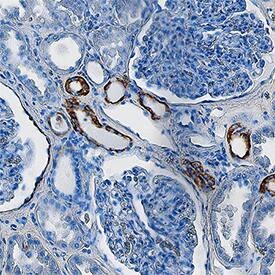 Cytokeratin 19 was detected in immersion fixed paraffin-embedded sections of human kidney using Sheep Anti-Human Cytokeratin 19 Antigen Affinity-purified Polyclonal Antibody (Catalog # AF3506) at 3 µg/mL overnight at 4 °C. Tissue was stained using the Anti-Sheep HRP-DAB Cell & Tissue Staining Kit (brown; Catalog # CTS019) and counterstained with hematoxylin (blue). Specific staining was localized to cytoplasm in convoluted tubules. View our protocol for Chromogenic IHC Staining of Paraffin-embedded Tissue Sections.