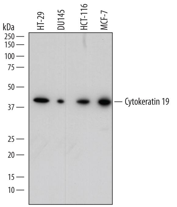 Western blot shows lysates of HT-29 human colon adenocarcinoma cell line, DU145 human prostate carcinoma cell line, HCT-116 human colorectal carcinoma cell line, and MCF-7 human breast cancer cell line. PVDF membrane was probed with 0.1 µg/mL of Sheep Anti-Human Cytokeratin 19 Antigen Affinity-purified Polyclonal Antibody (Catalog # AF3506) followed by HRP-conjugated Anti-Sheep IgG Secondary Antibody (Catalog # HAF016). A specific band was detected for Cytokeratin 19 at approximately 40 kDa (as indicated). This experiment was conducted under reducing conditions and using Immunoblot Buffer Group 1.
