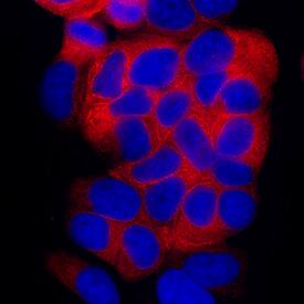 Cytokeratin 19 was detected in immersion fixed MCF-7 human breast cancer cell line using Mouse Anti-Human Cytokeratin 19 Monoclonal Antibody (Catalog # MAB35061) at 8 µg/mL for 3 hours at room temperature. Cells were stained using the NorthernLights™ 557-conjugated Anti-Mouse IgG Secondary Antibody (red; Catalog # NL007) and counterstained with DAPI (blue). Specific staining was localized to cytoplasm. View our protocol for Fluorescent ICC Staining of Cells on Coverslips.