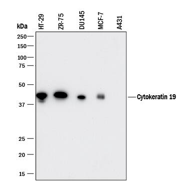 <b>Orthogonal Strategies Validation. </b>Western blot shows lysates of HT-29 human colon adenocarcinoma cell line, ZR-75 human breast cancer cell line, DU145 human prostate carcinoma cell line, MCF-7 human breast cancer cell line, and A431 human epithelial carcinoma cell line. PVDF membrane was probed with 0.25 µg/mL of Mouse Anti-Human Cytokeratin 19 Monoclonal Antibody (Catalog # MAB35061) followed by HRP-conjugated Anti-Mouse IgG Secondary Antibody (Catalog # HAF018). A specific band was detected for Cytokeratin 19 at approximately 40 kDa (as indicated). This experiment was conducted under reducing conditions and using Immunoblot Buffer Group 1.