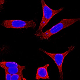 Cytokeratin 8 was detected in immersion fixed MCF-7 human breast cancer cell line using Mouse Anti-Human Cytokeratin 8 Monoclonal Antibody (Catalog # MAB3165) at 25 µg/mL for 3 hours at room temperature. Cells were stained using the NorthernLights™ 557-conjugated Anti-Mouse IgG Secondary Antibody (red; Catalog # NL007) and counterstained with DAPI (blue). Specific staining was localized to cytoplasm. View our protocol for Fluorescent ICC Staining of Cells on Coverslips.