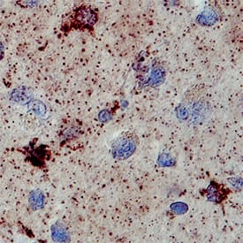 Cytosolic Sulfotransferase 1A1/SULT1A1 was detected in immersion fixed paraffin-embedded sections of human brain using Human Cytosolic Sulfotransferase 1A1/SULT1A1 Monoclonal Antibody (Catalog # MAB5546) at 15 µg/mL overnight at 4 °C. Before incubation with the primary antibody, tissue was subjected to heat-induced epitope retrieval using Antigen Retrieval Reagent-Basic (Catalog # CTS013). Tissue was stained using the Anti-Mouse HRP-DAB Cell & Tissue Staining Kit (brown; Catalog # CTS002) and counterstained with hematoxylin (blue). Specific staining was localized to neurons and glial cells (punctate). View our protocol for Chromogenic IHC Staining of Paraffin-embedded Tissue Sections.