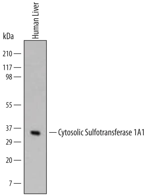 Western blot shows lysates of human liver tissue. PVDF Membrane was probed with 0.5 µg/mL of Human Cytosolic Sulfotransferase 1A1/SULT1A1 Monoclonal Antibody (Catalog # MAB5546) followed by HRP-conjugated Anti-Mouse IgG Secondary Antibody (Catalog # HAF007). A specific band was detected for Cytosolic Sulfotransferase 1A1/SULT1A1 at approximately 35 kDa (as indicated). This experiment was conducted under reducing conditions and using Immunoblot Buffer Group 1.