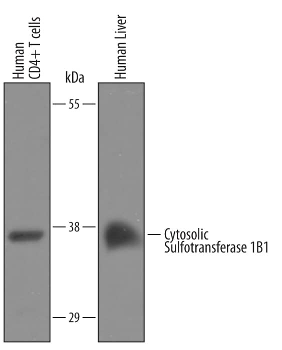 Western Blot Cytosolic Sulfotransferase 1B1/SULT1B1 Antibody [Unconjugated]
